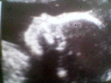 profil de bb au 5eme mois